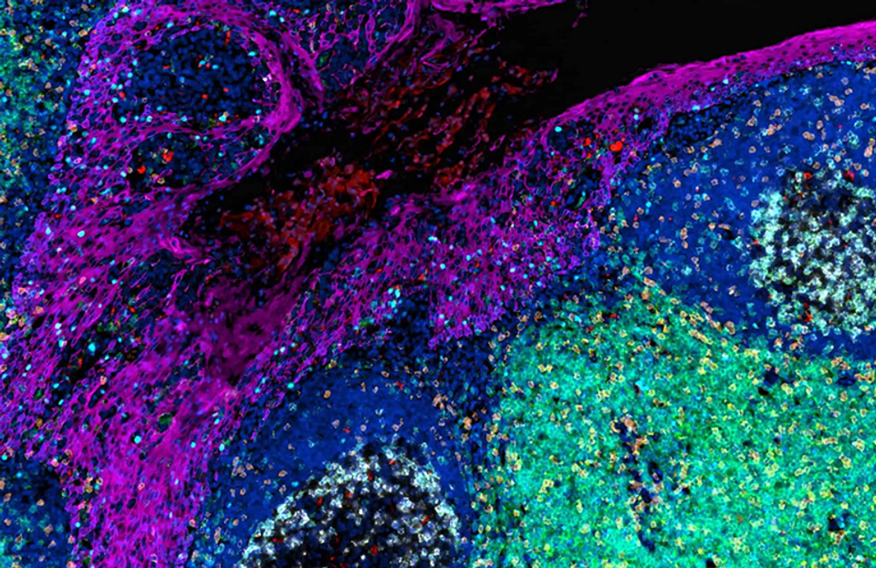 Nucleai's AI-powered spatial biology could revolutionize oncology R&D-thumbnail