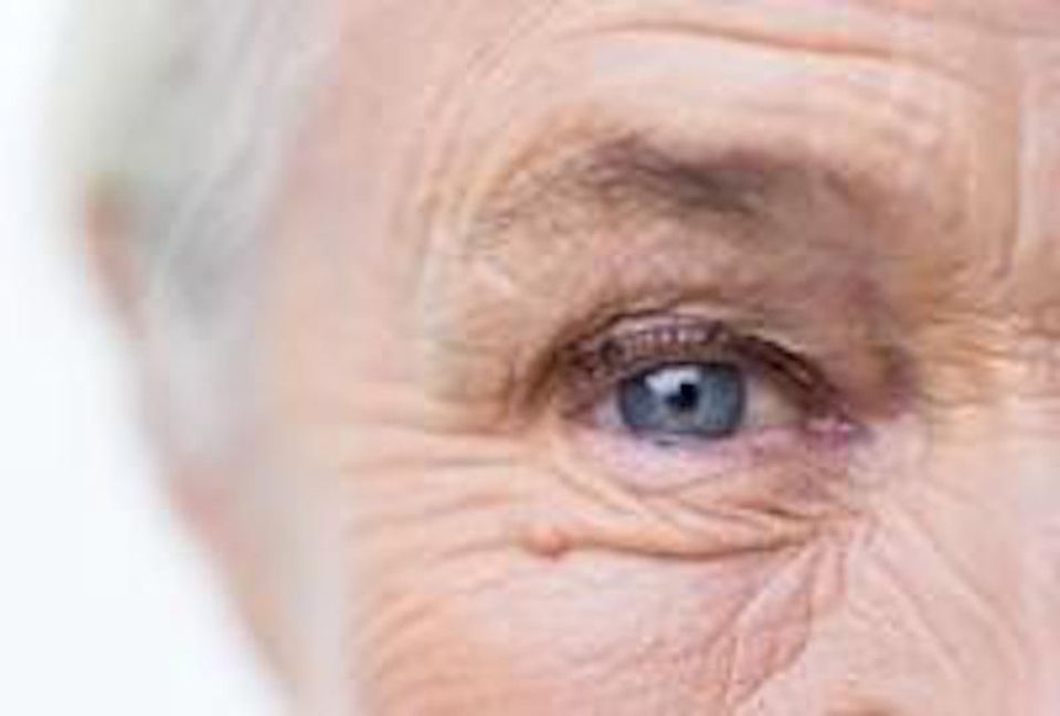 Gene therapy shows promise in treating wet AMD-thumbnail