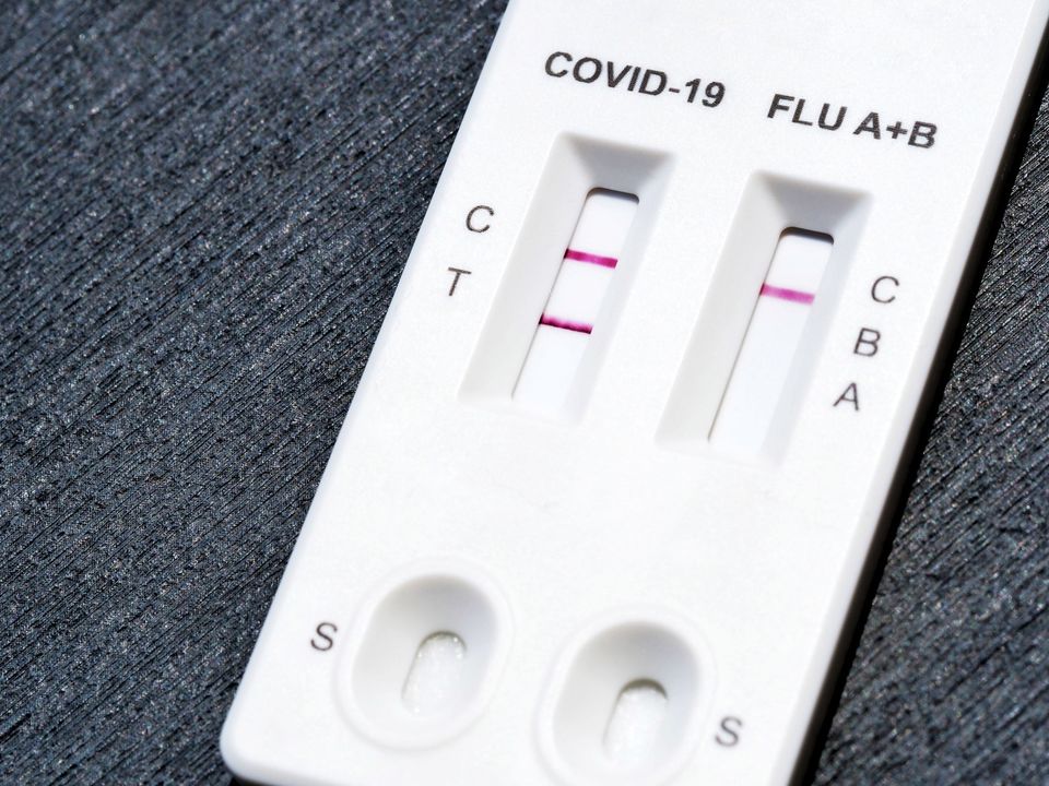 Distinct genetic risk factors for influenza and COVID-19 identified-thumbnail