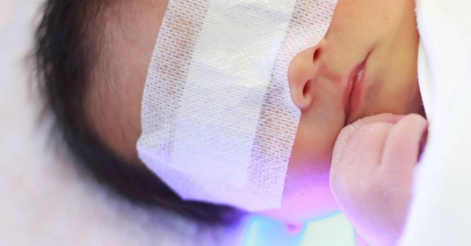 CHOC Receives National Recognition for Treating Newborns with Jaundice-thumbnail