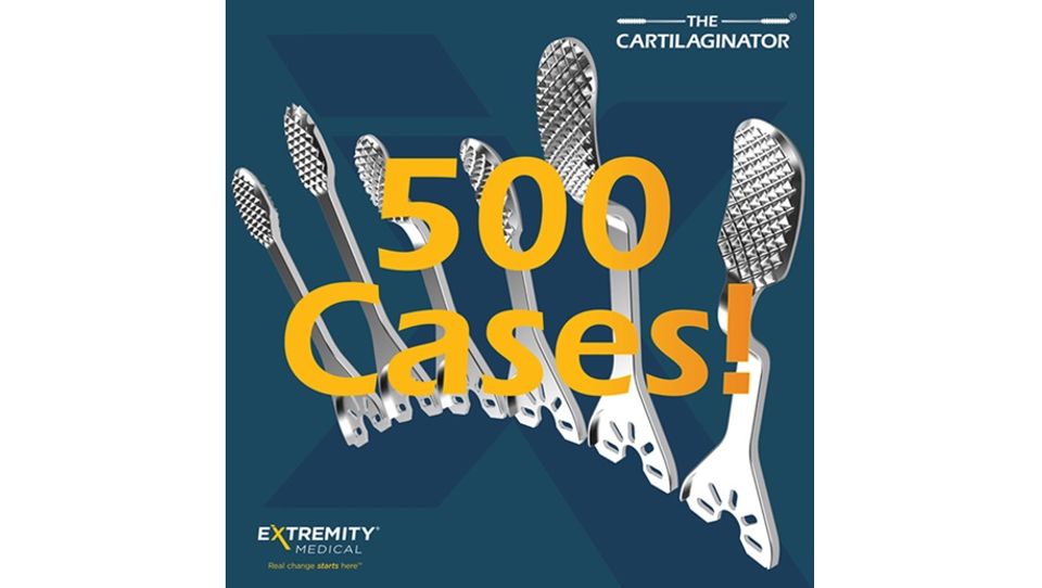 Extremity Medical's Cartilaginator reaches 500th case milestone-thumbnail