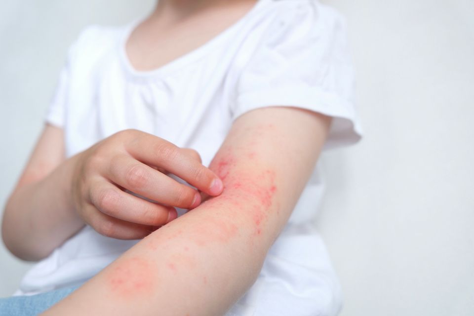 Experts discuss safe use of biologic therapies in pediatric patients with skin conditions-thumbnail