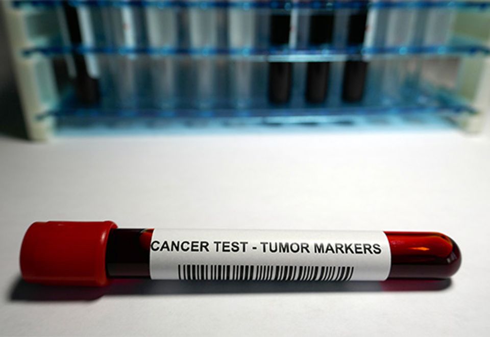 California law mandates biomarker testing for cancer patients-thumbnail