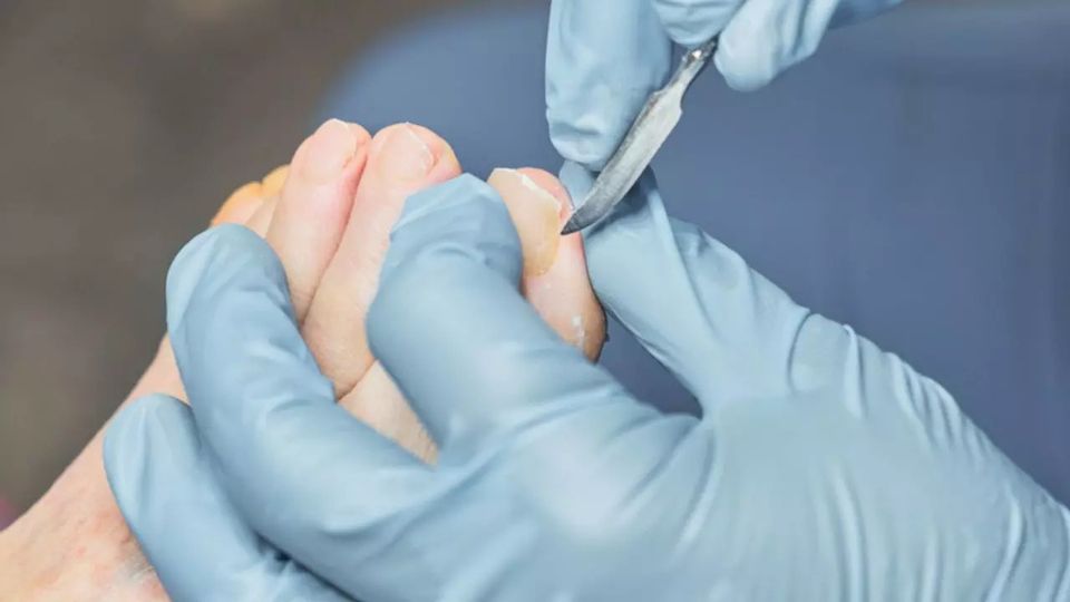 Choosing the Right Plastic Surgeon for Treating Diabetic Foot-thumbnail